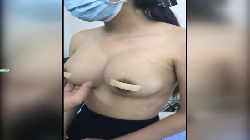 从咸鱼淘来的整容医院偷拍视频做完隆胸手术的妹子来医院复查前后对比这医生的手艺还真不错